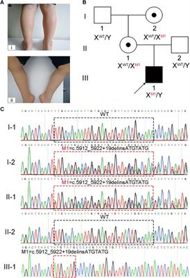 A novel splicing mutation identified in a DMD patient: a case report